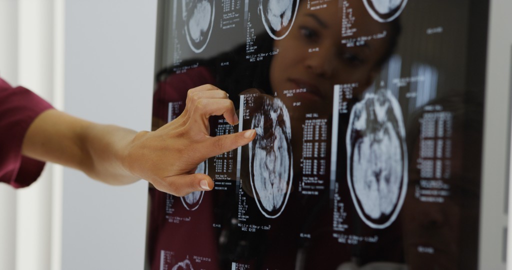 Brain Injuries from Motor Vehicle Accidents in Alberta