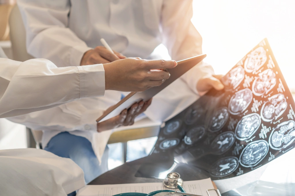 What Is Post-Concussion Syndrome?